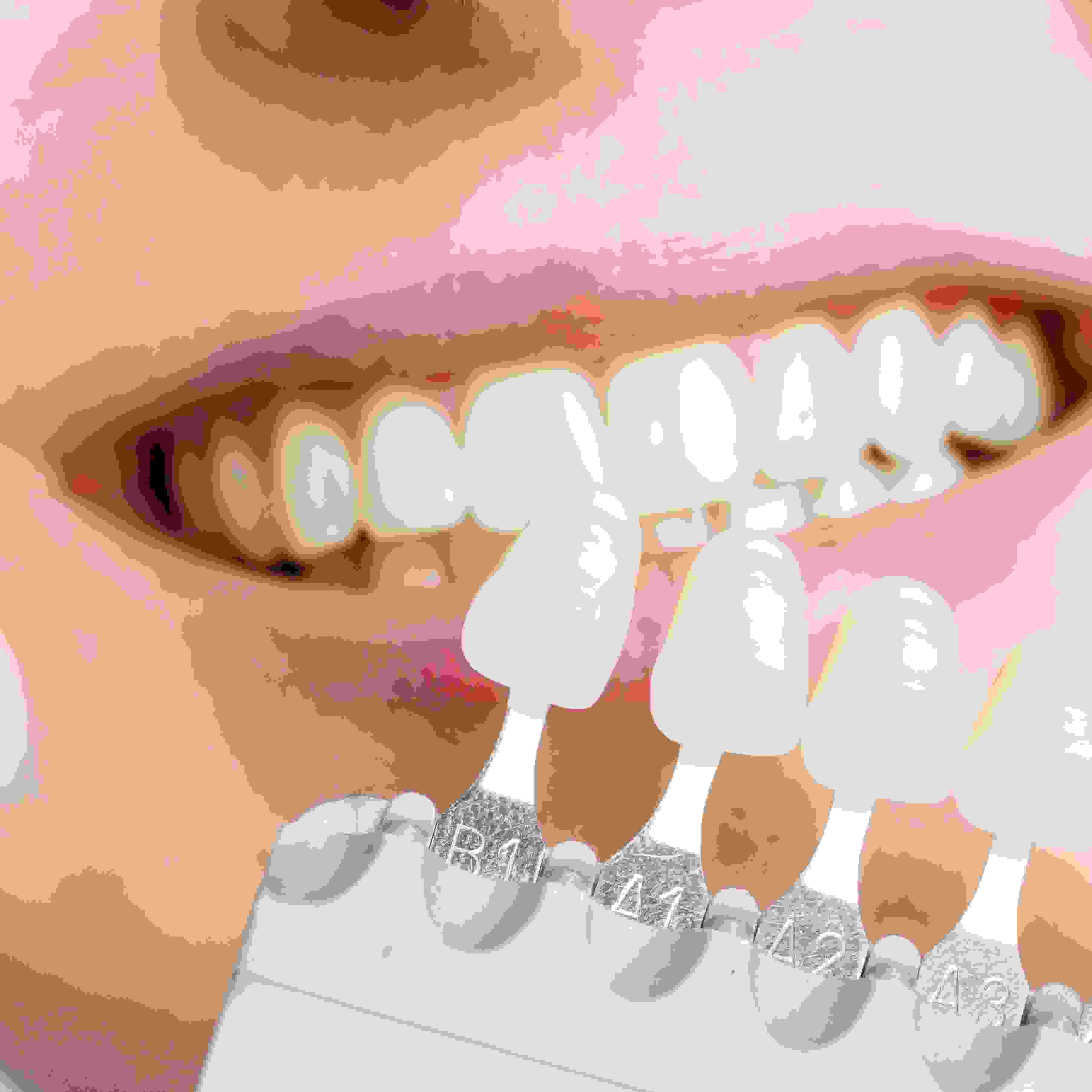 Bleaching